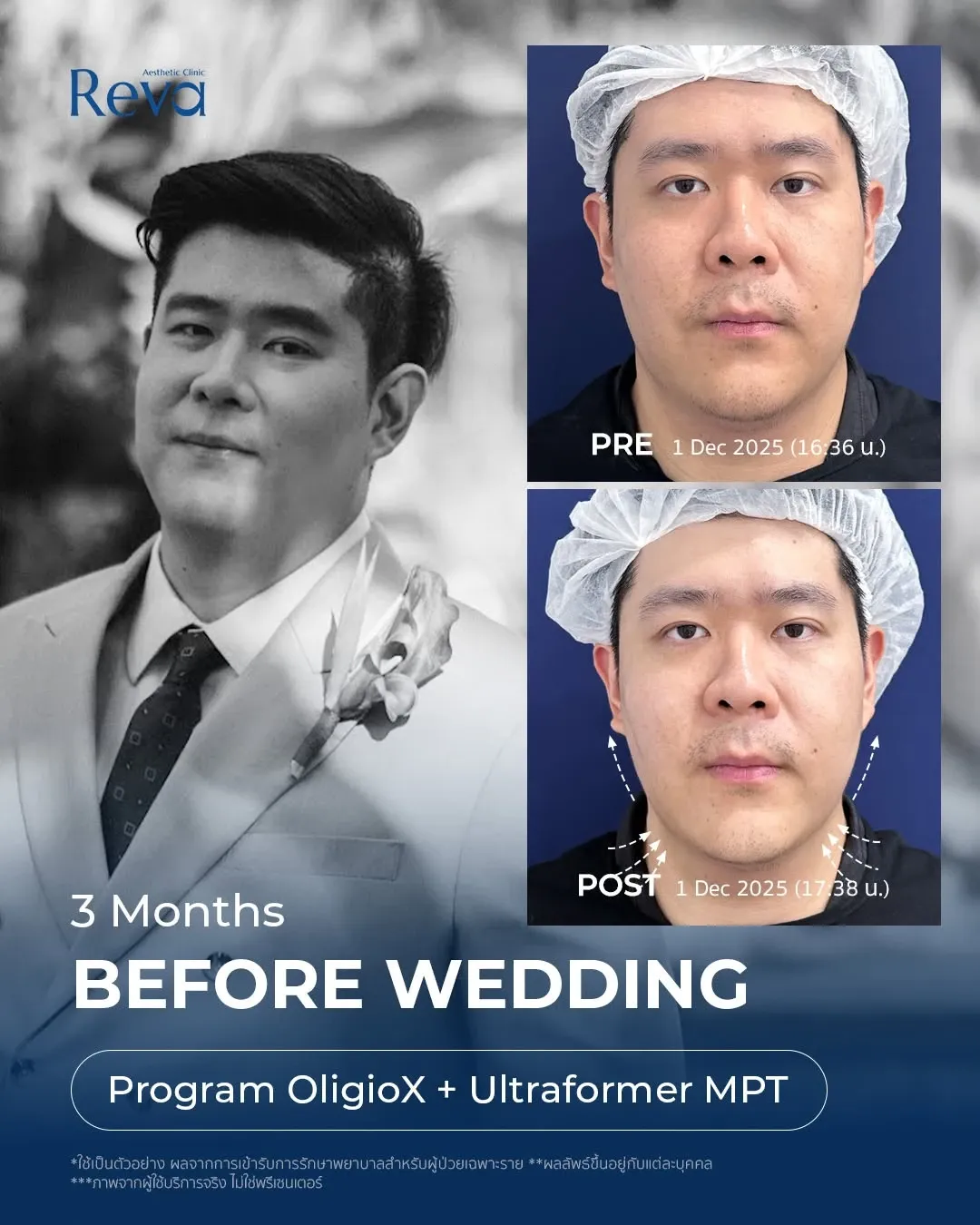 ทำหน้าเจ้าบ่าว