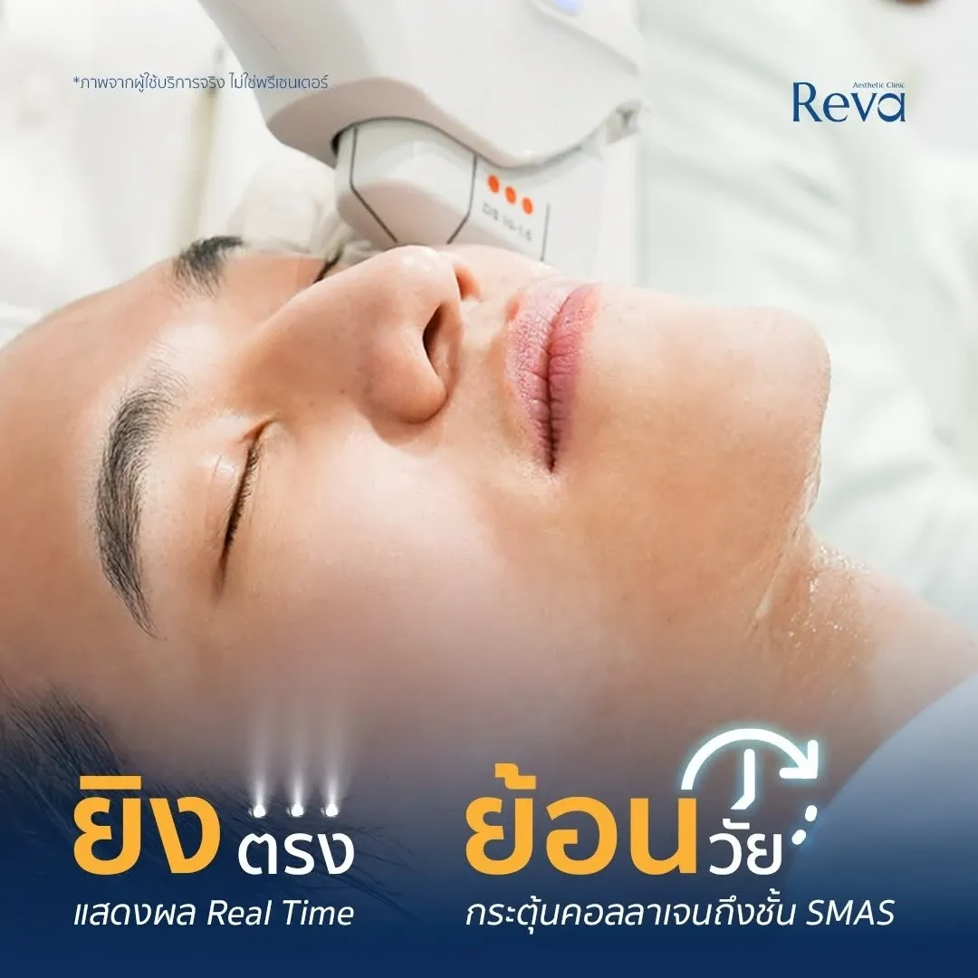 รีวิวประสบการณ์ Program Ultherapy Private Lounge ที่ Reva Aesthetic Clinic พร้อมพื้นที่ส่วนตัวสำหรับผู้รับบริการ