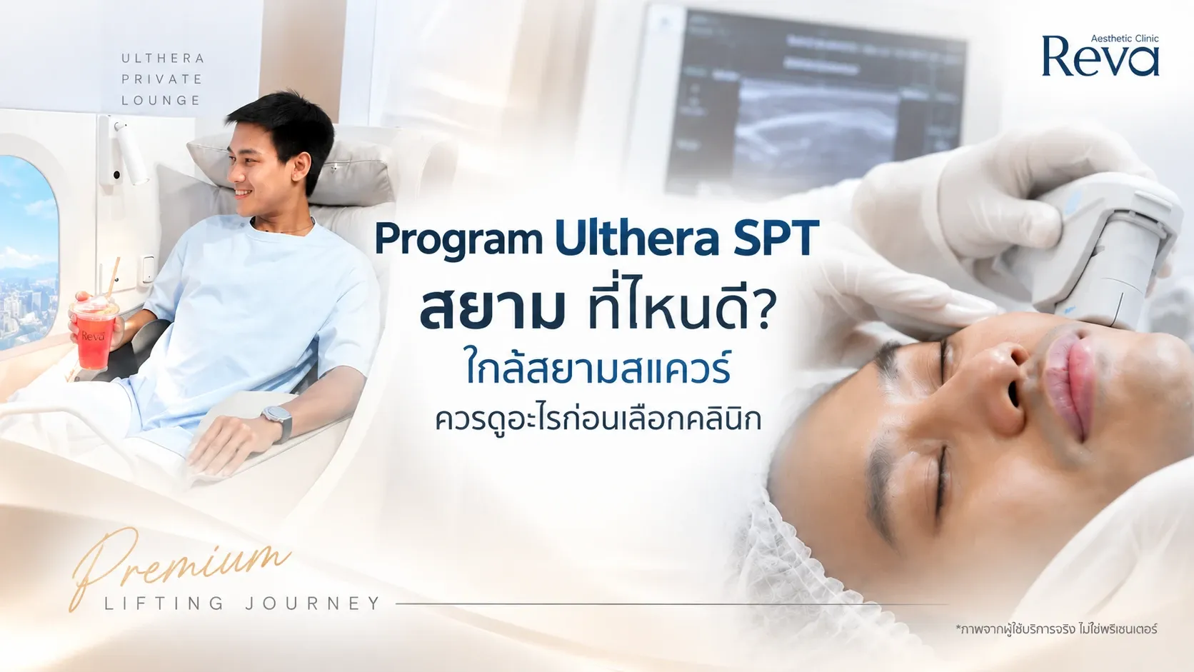 Ulthera สยาม