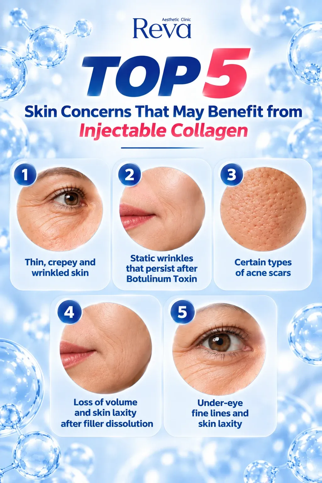 TOP 5 Skin Concerns That May Benefit from Injectable Collagen