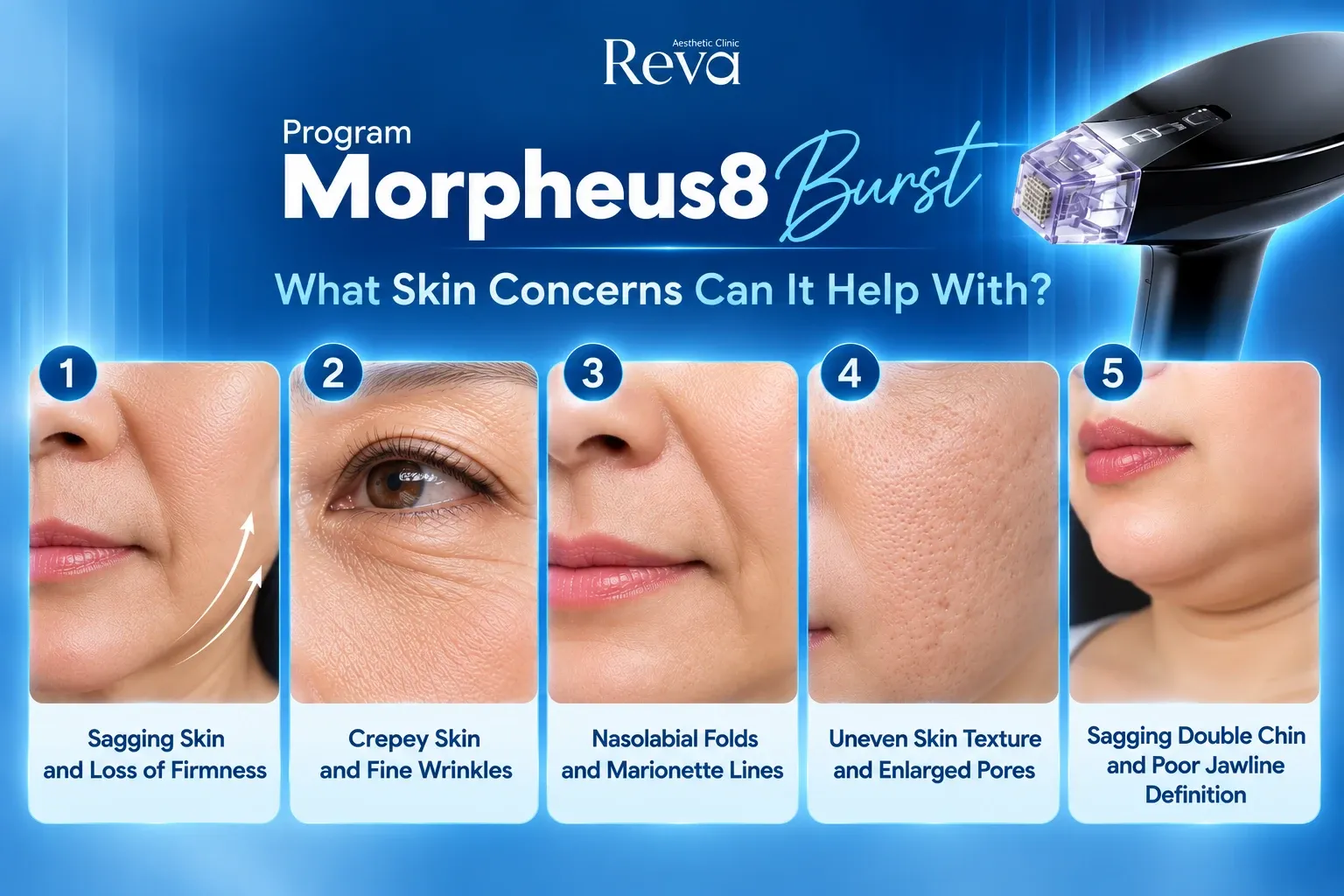 What Skin Concerns Can Program Morpheus8 Burst Address
