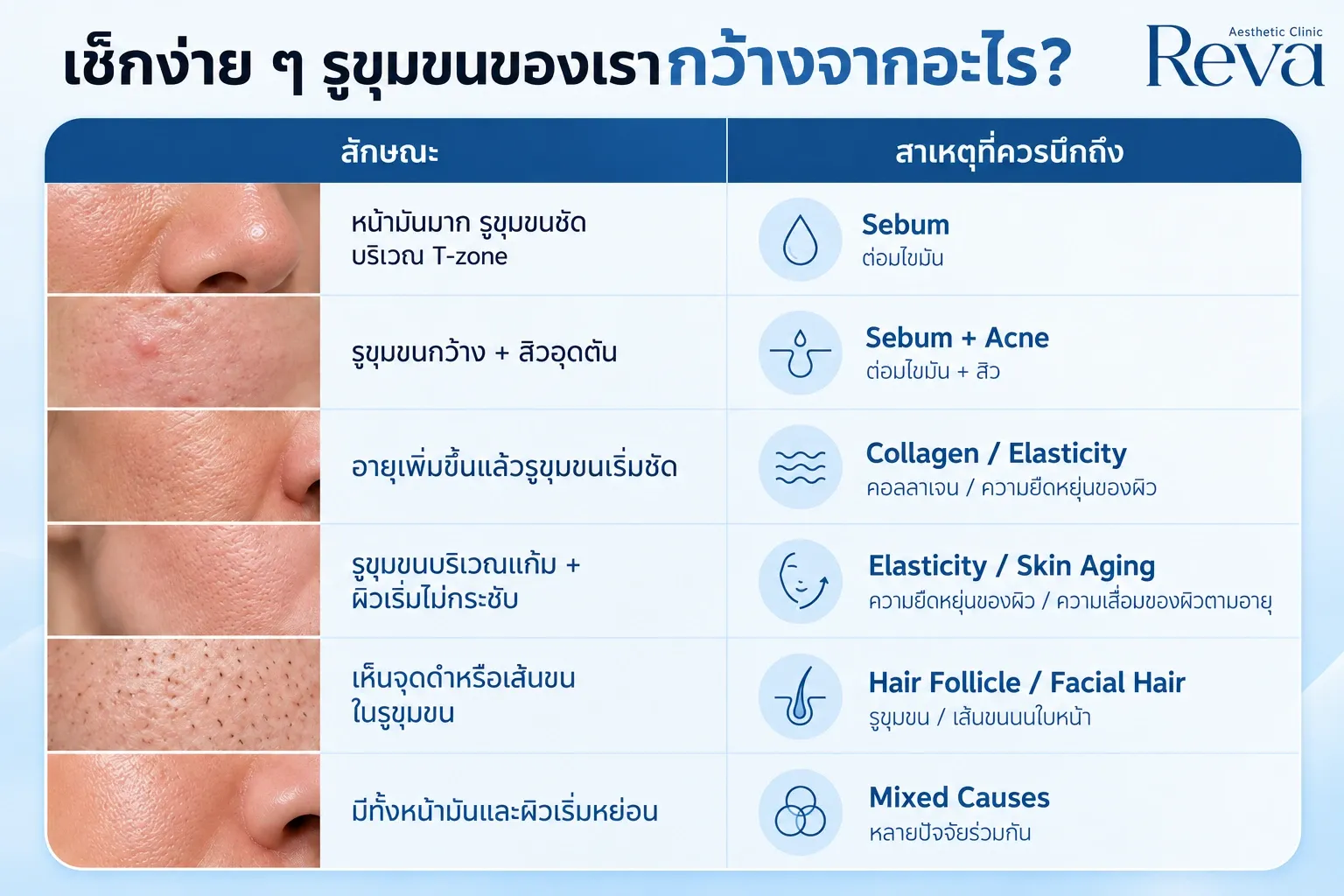 รูขุมขนของเรากว้างจากอะไร