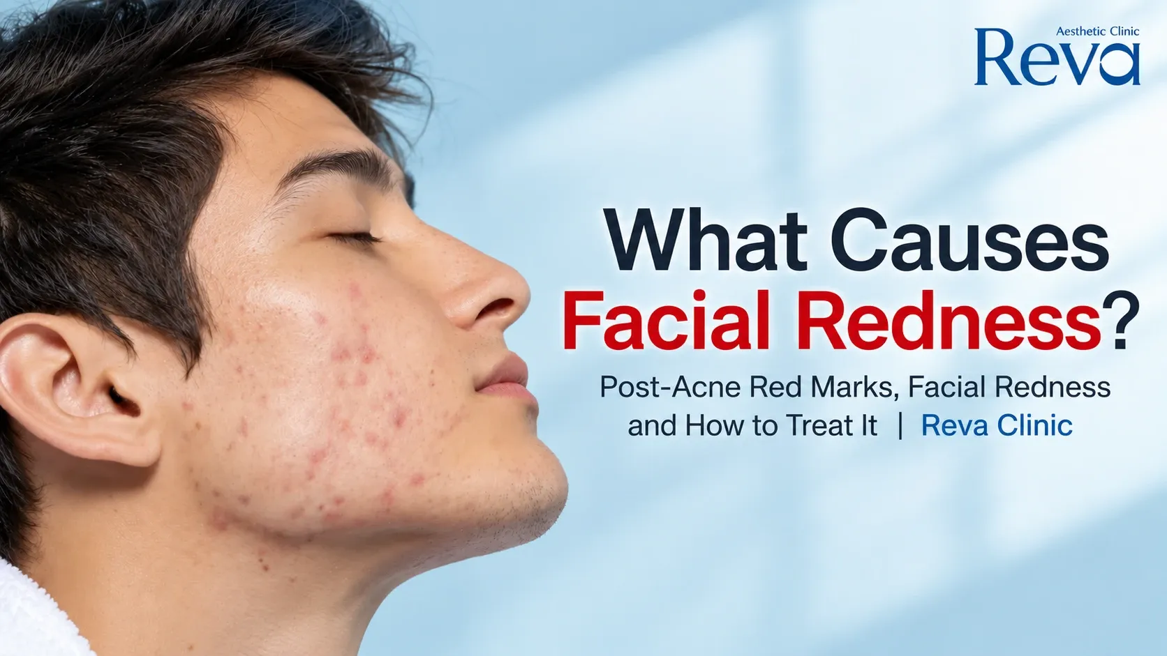 Facial Redness