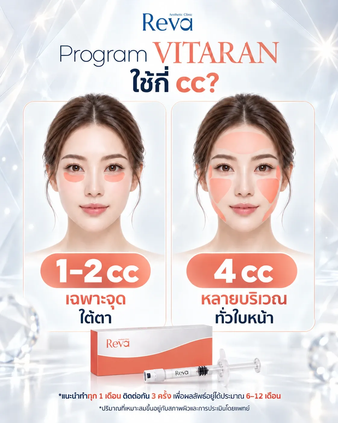 Vitaran ควรใช้กี่ cc?