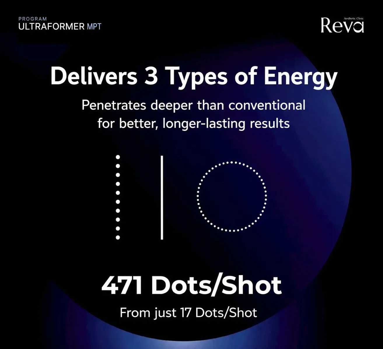Infographic of Program Ultraformer MPT showing three energy patterns and dots per shot as printed on the graphic