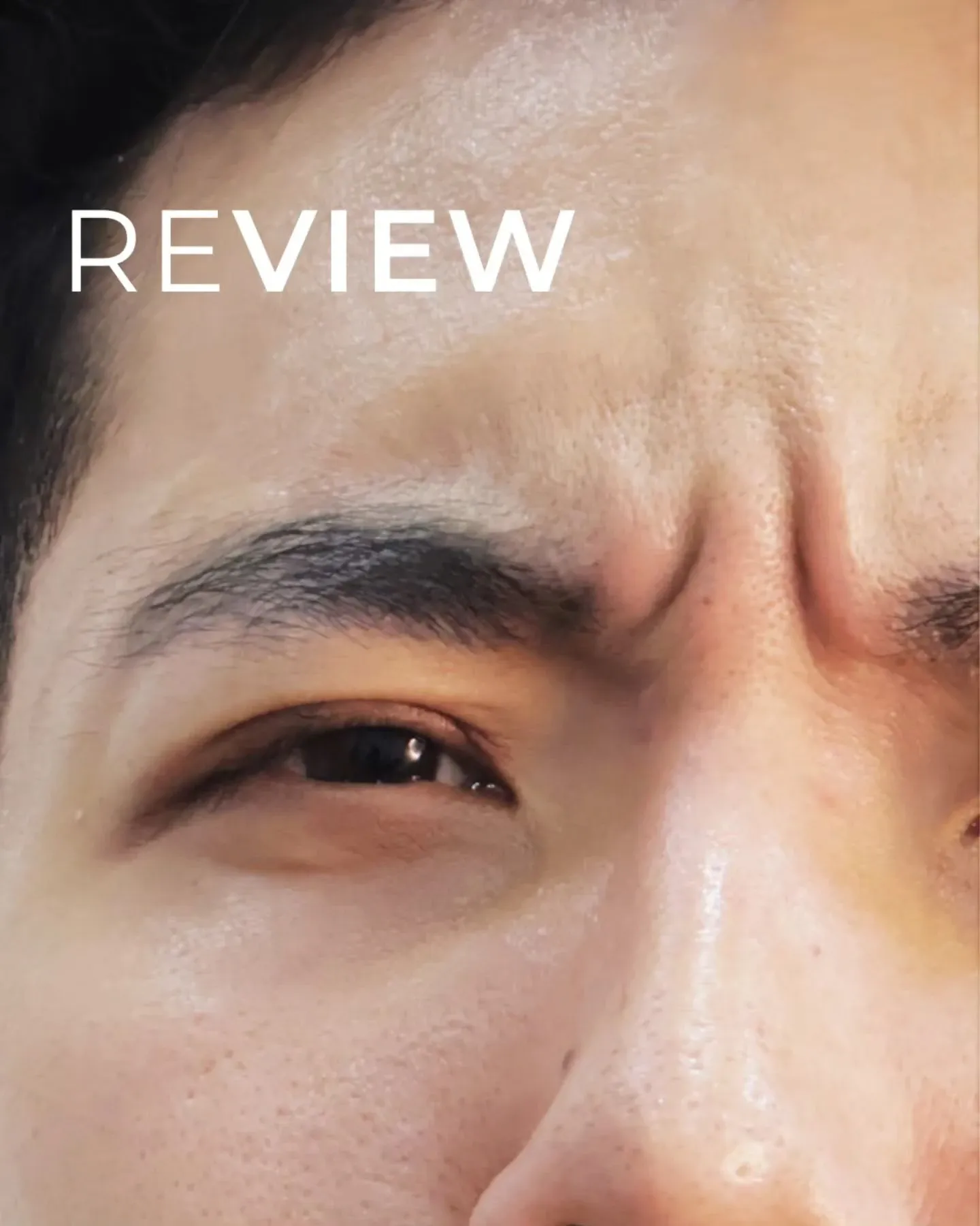 รีวิว xeomin