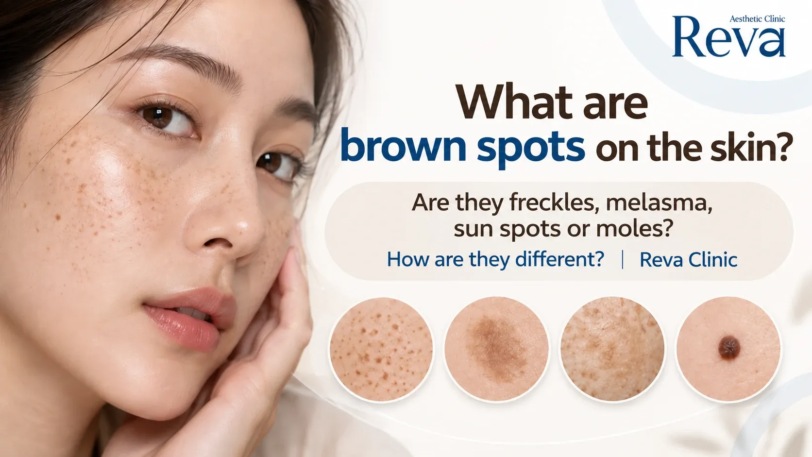 Brown Spots on the Face
