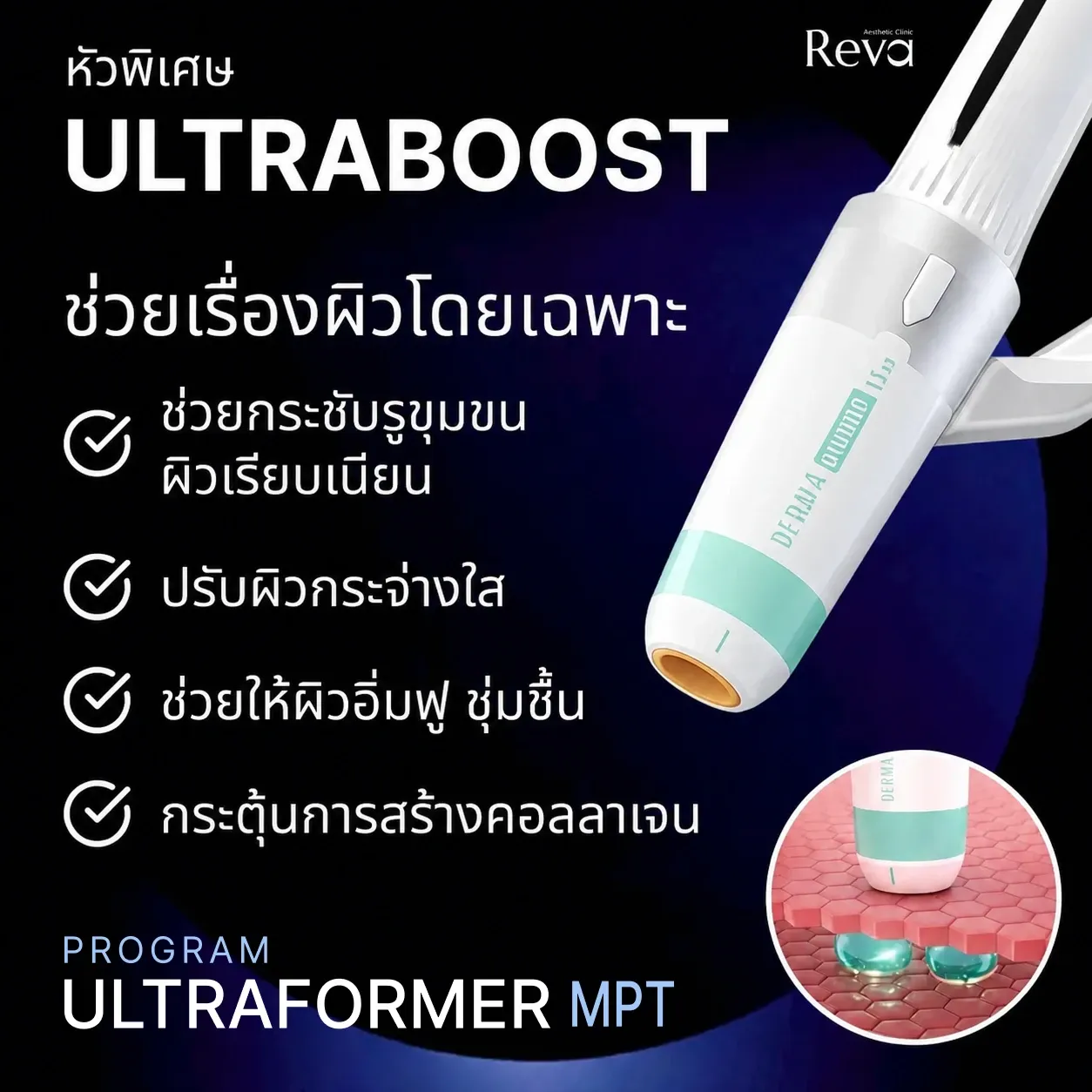 อินโฟกราฟิกหัว Ultraboost ใน Program Ultraformer MPT สำหรับงานผิว เช่น รูขุมขนและความชุ่มชื้น