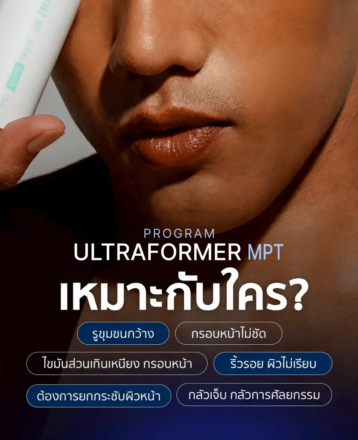 กราฟิกระบุกลุ่มปัญหา เช่น รูขุมขน กรอบหน้า เหนียง ริ้วรอย และอยากยกกระชับโดยไม่ผ่าตัด