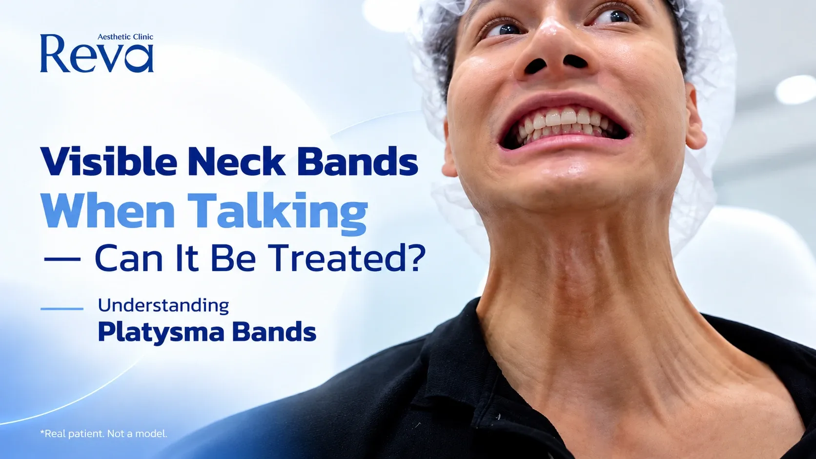 Platysma Bands and How Can They Be Treated?