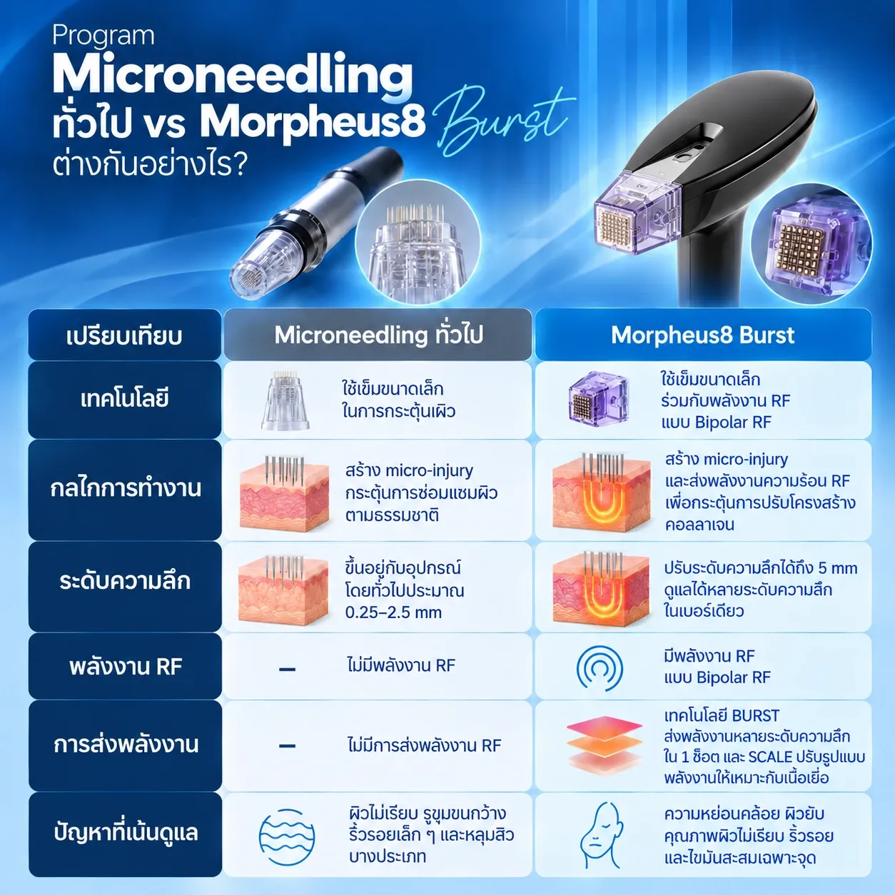 Morpheus8 Burst ต่างจาก Microneedling ทั่วไปอย่างไร