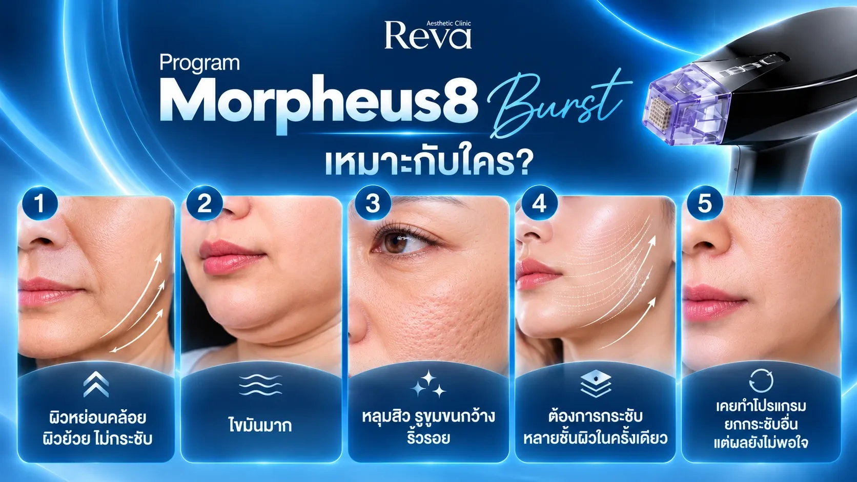 Program Morpheus8 Burst เหมาะกับใคร?