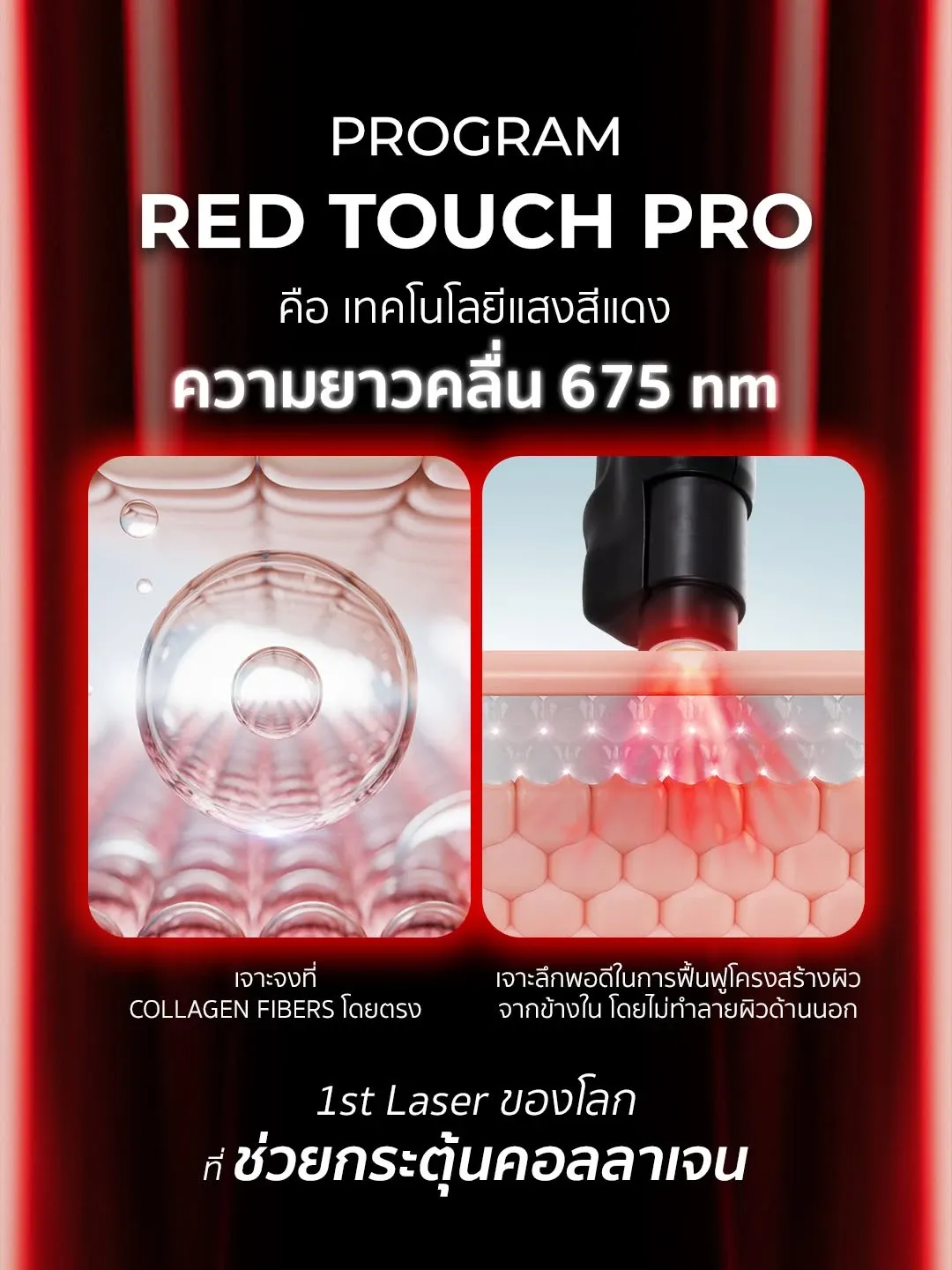 เลเซอร์กระตุ้นคอลลาเจน