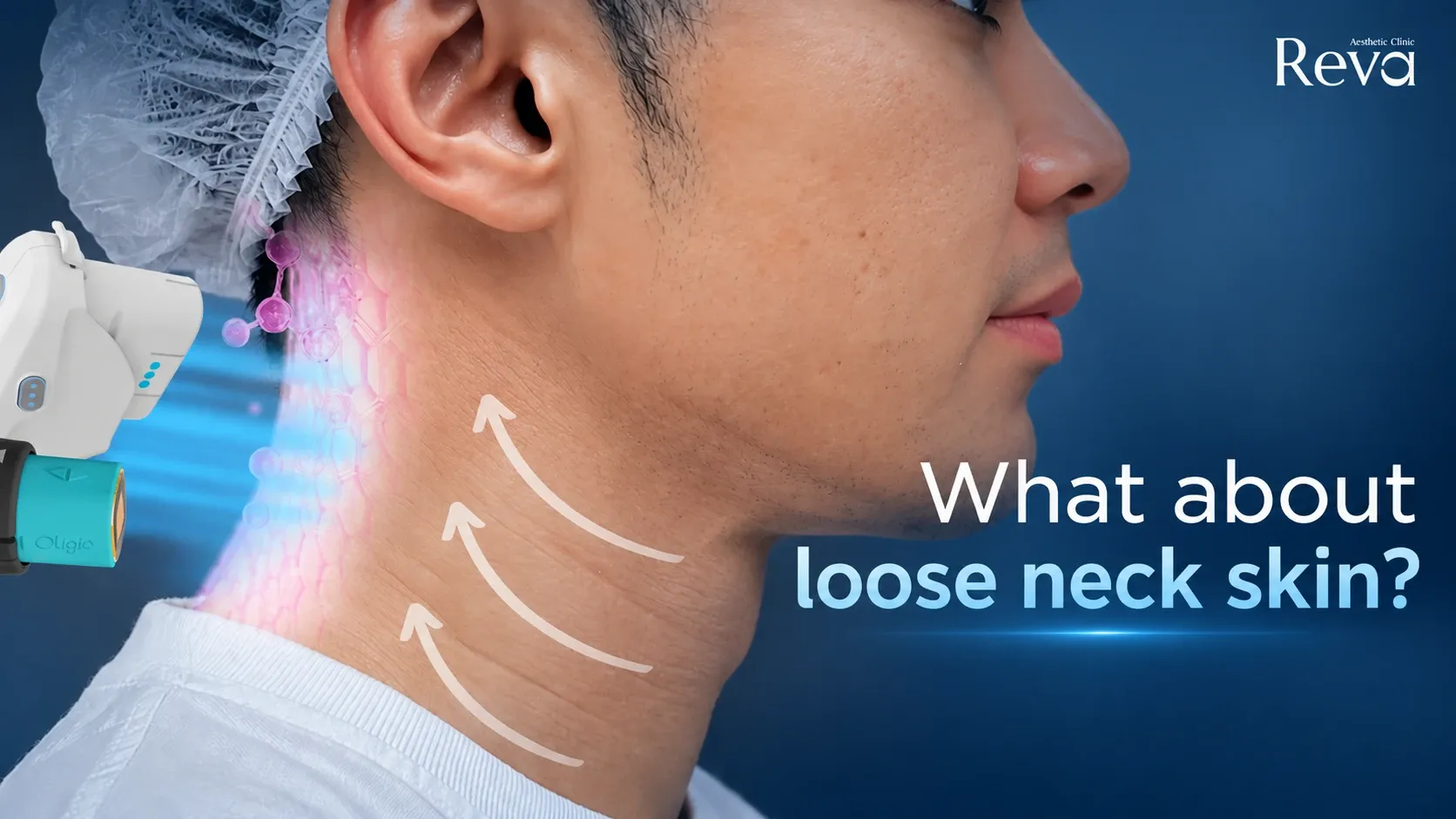 Less Firm Neck Skin?