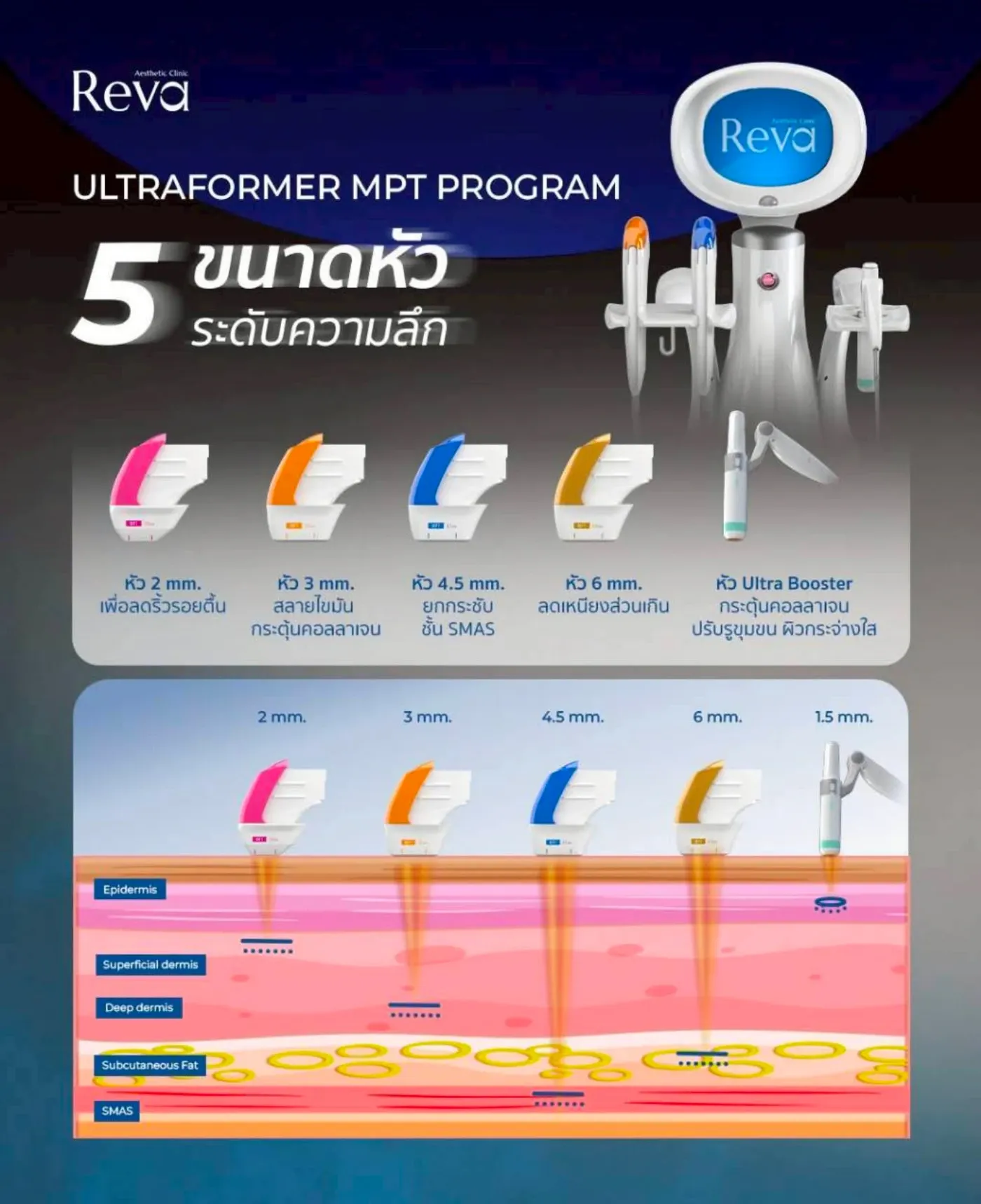 อินโฟกราฟิกหัว 2, 3, 4.5, 6 มม. และ Ultra Booster พร้อมแผนภาพความลึกชั้นผิว