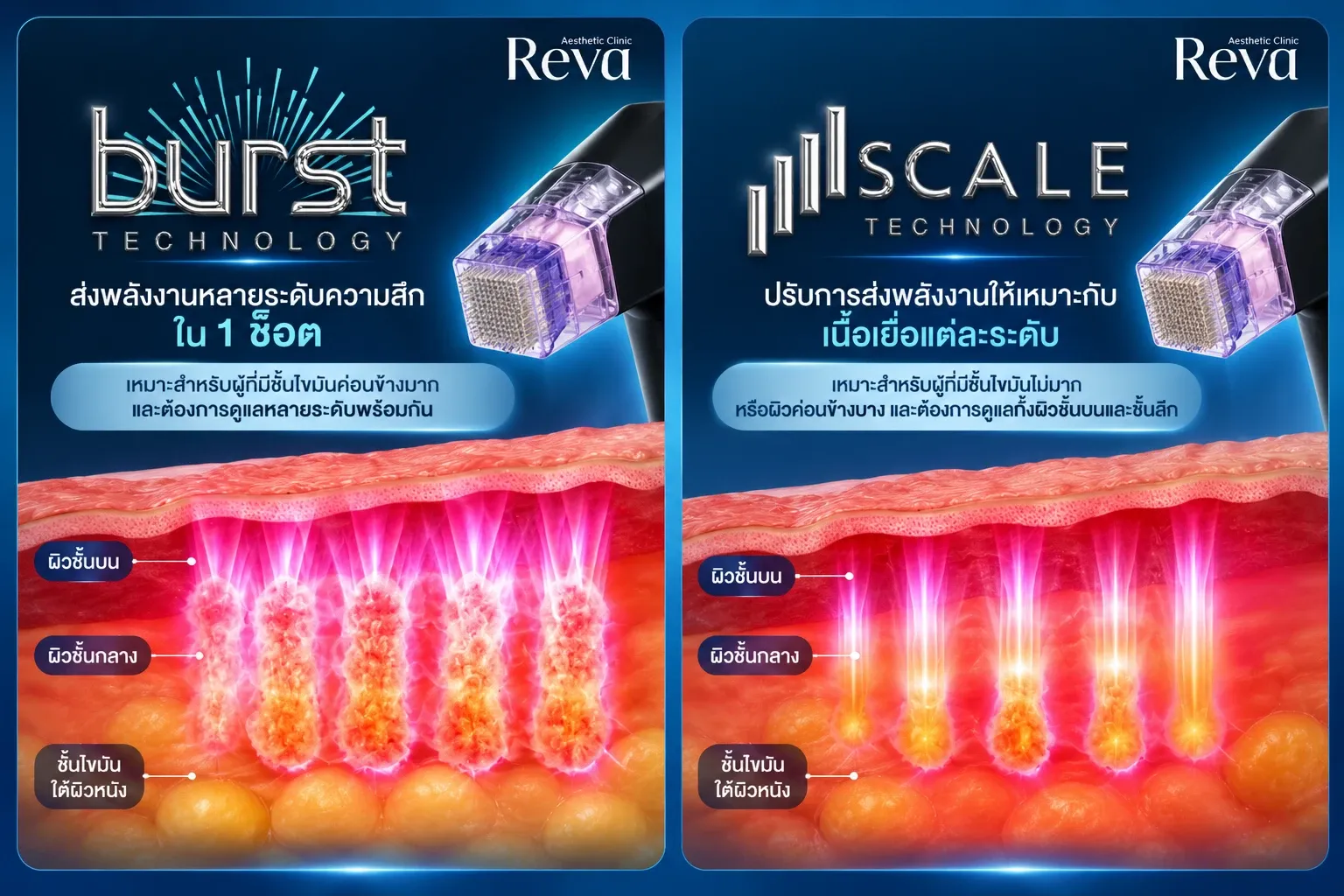  BURST และ SCALE เทคโนโลยีใหม่ ของ morpheus