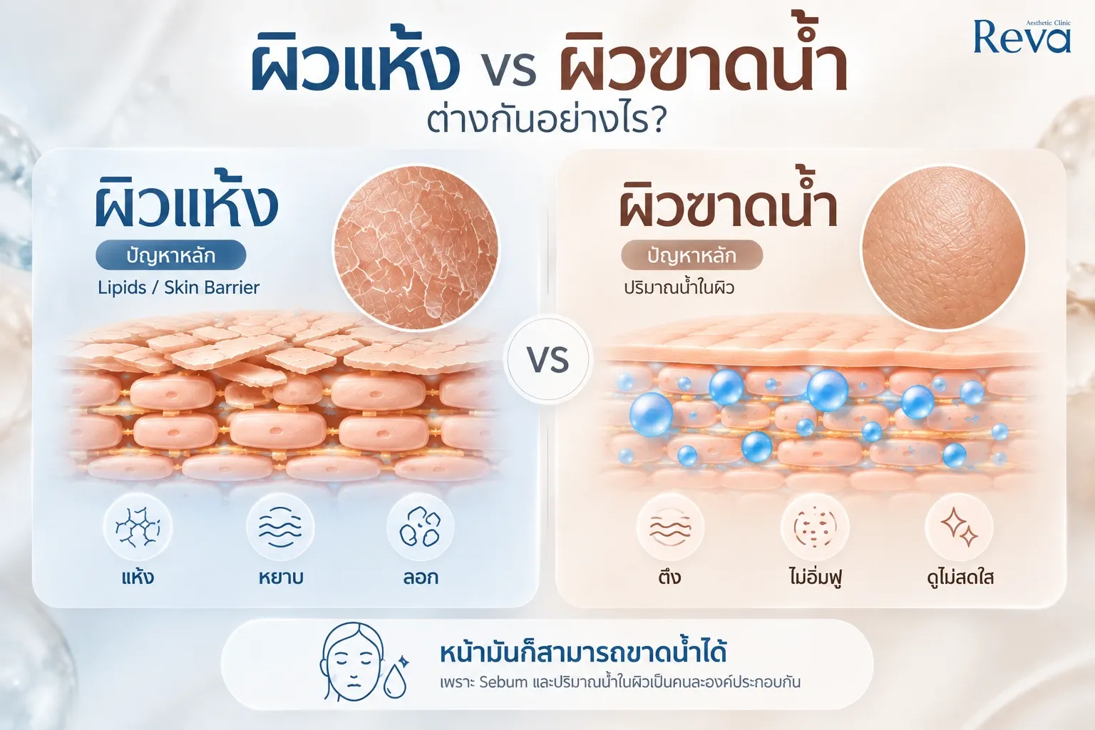 ผิวแห้ง vs ผิวขาดน้ำ