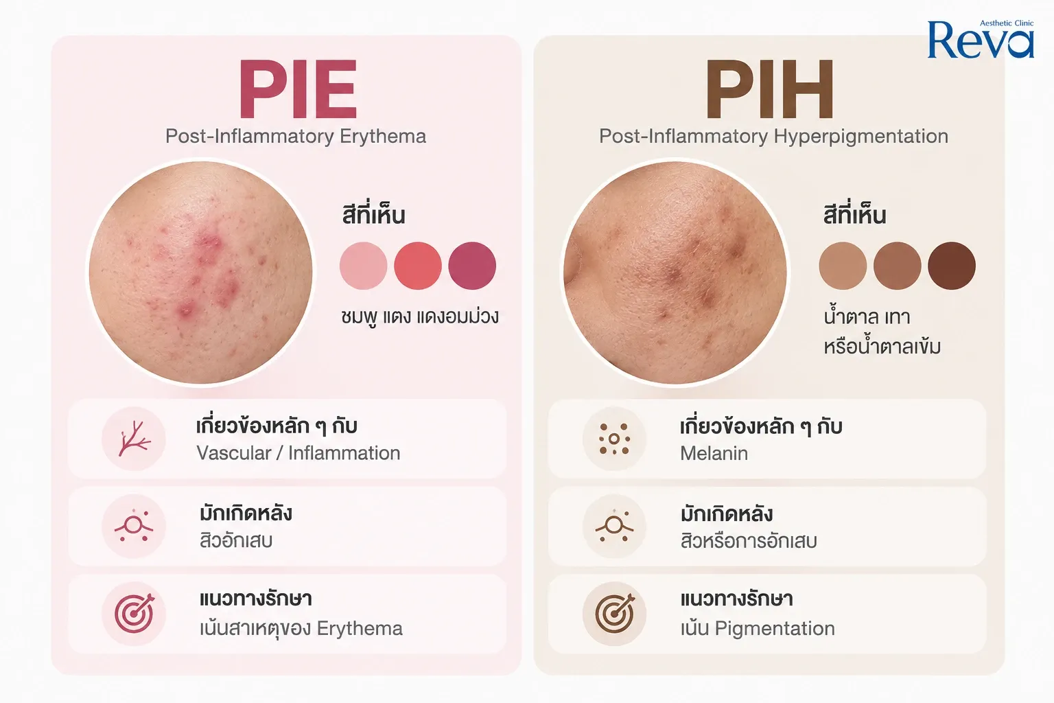 รอยแดง vs รอยดำ